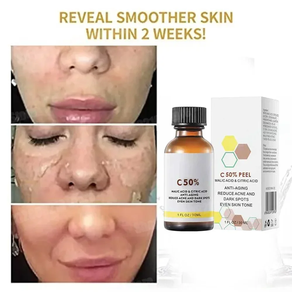 Salicylic Acid Cleanser - 살리실산 페이스 페이셜 필 중화제 페이스