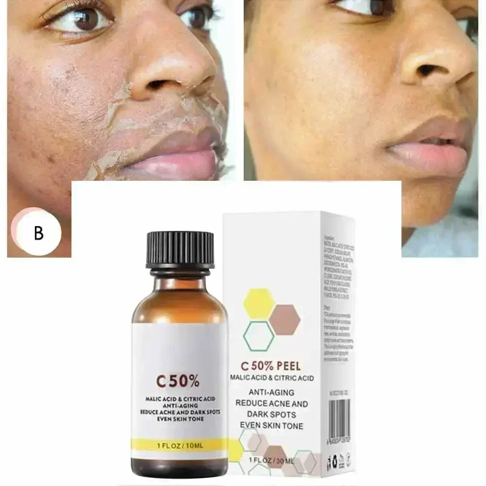 살리실산 페이스 페이셜 필 중화제 페이스 딥 홈 케미컬 - Salicylic Acid Cleanser 리뷰 및 가격