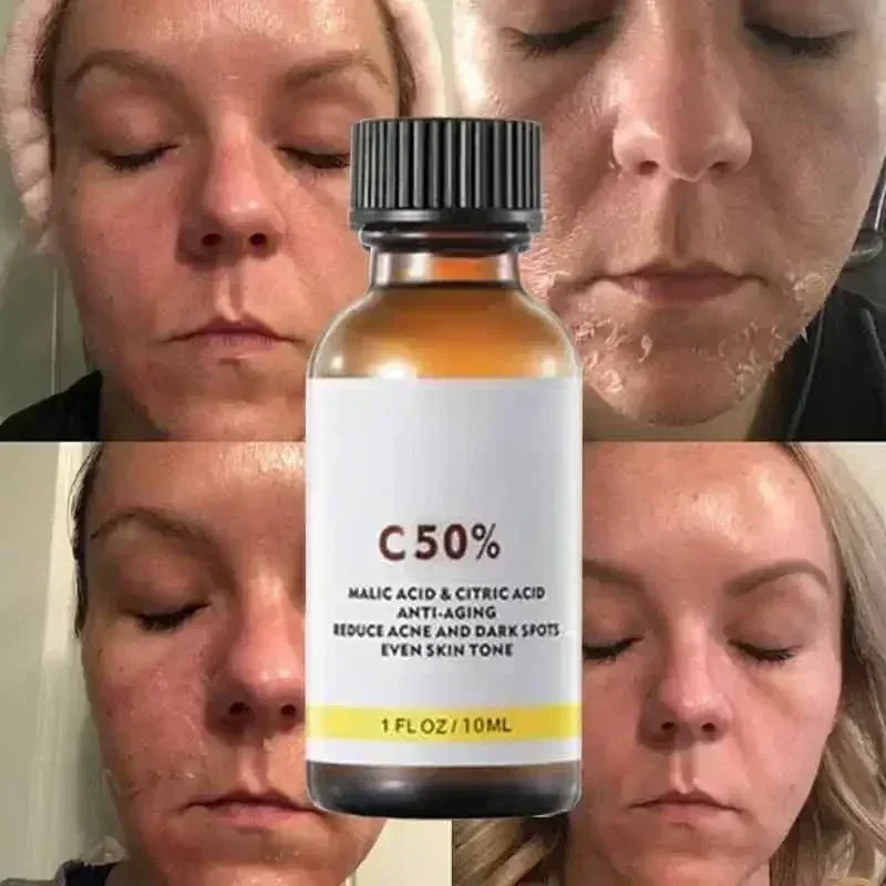 살리실산 페이스 페이셜 필 중화제 페이스 딥 홈 케미컬 - Salicylic Acid Cleanser 리뷰 및 가격