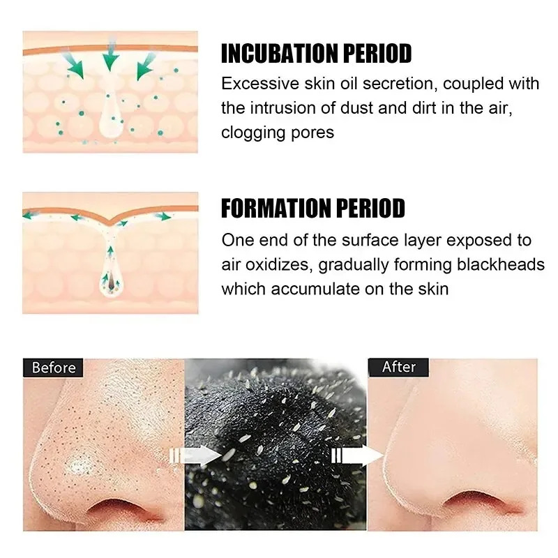 10/150PCS 블랙헤드 제거 마스크 코 스트립 수축 - Charcoal Pore Strip 리뷰 및 가격