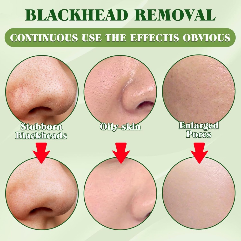 15개입 숯 블랙헤드 제거 코팩, 필오프 모공 클렌징  - Charcoal Pore Strip 리뷰 및 가격