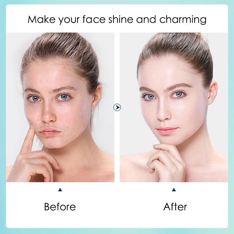 10pcs 히알루 론산 하이 드레이팅 페이셜 마스크 시 - Skincare Viral Tiktok 리뷰 및 가격